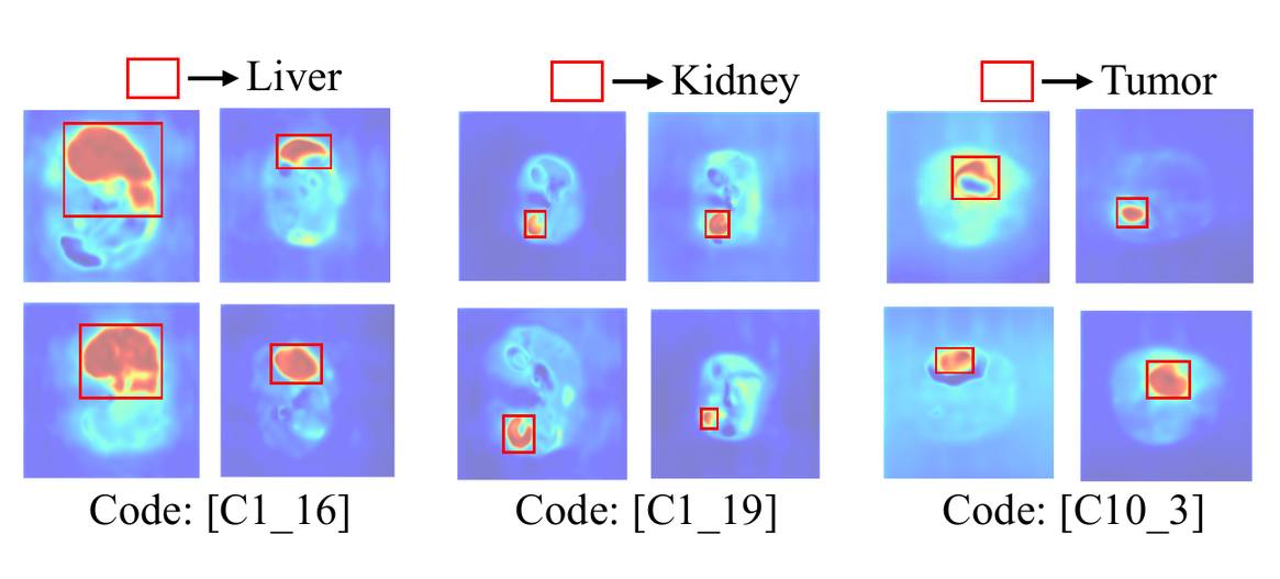 Region codebook visualization